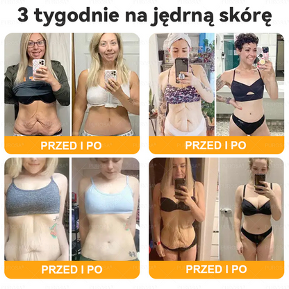 PUROSA®  Jad Pszczoły Kompleksowy Krem🥇pomaga w leczeniu problemów skórnych, takich jak: zmarszczki, blizny, plamy pigmentacyjne, rozstępy, trądzik, łuszczyca, egzema, zmiany skórne, podrażnienia, stany zapalne i inne problemy skórne🔥