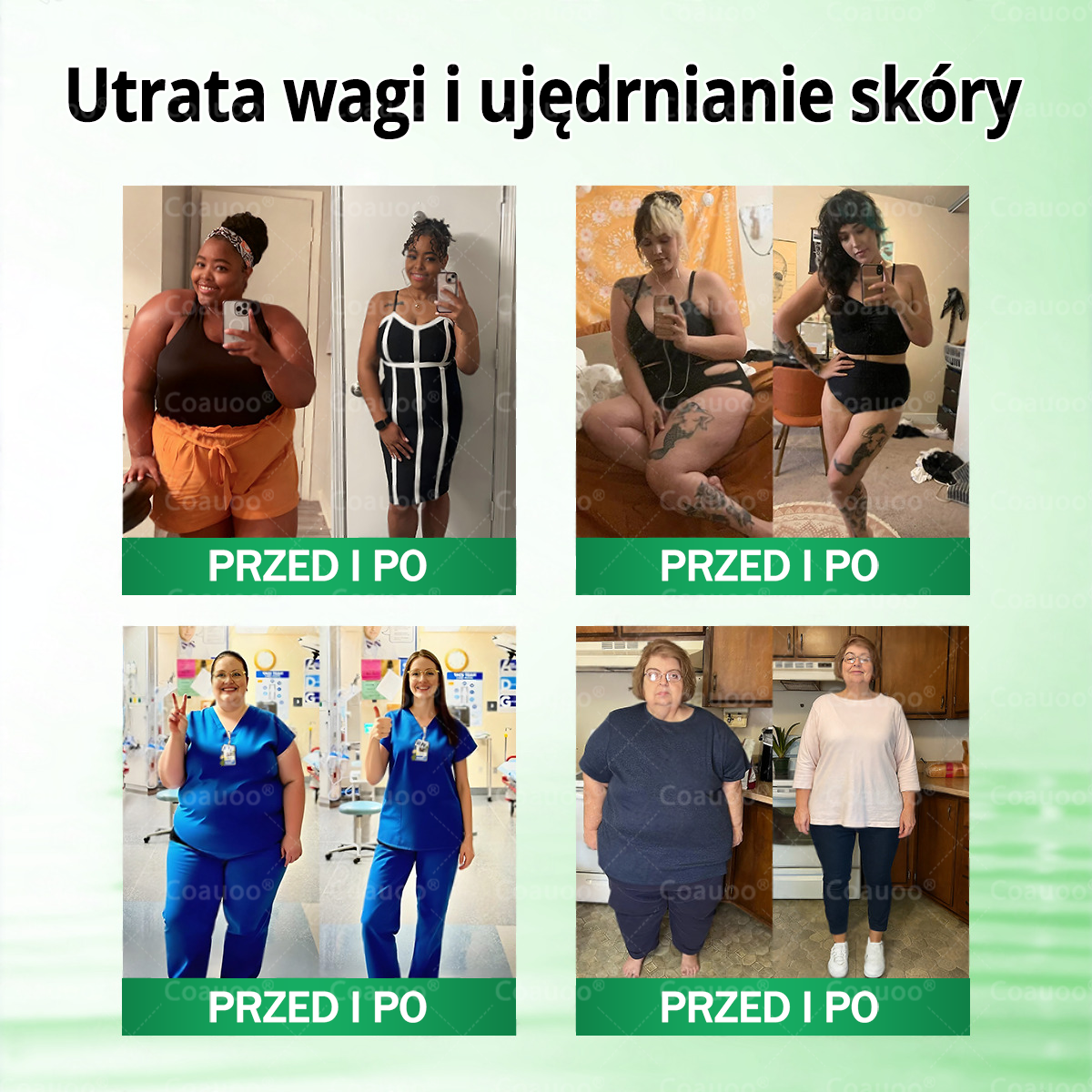 𝐂𝐨𝐚𝐮𝐨𝐨® Moringa × Berberyna × AMPK 10-w-1 Wsparcie metaboliczne, plaster z nanotechnologią mikroigłową  (Wystarczy raz dziennie, widoczne efekty w 7 dni) ✅ Na otyłość, wiotką skórę, cukrzycę, bezdech senny, problemy ze stawami i wiele innych ✨