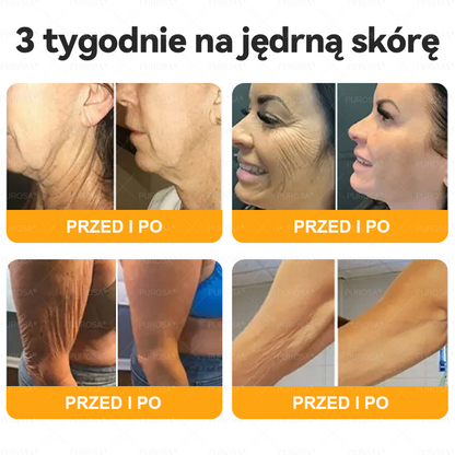 PUROSA®  Jad Pszczoły Kompleksowy Krem🥇pomaga w leczeniu problemów skórnych, takich jak: zmarszczki, blizny, plamy pigmentacyjne, rozstępy, trądzik, łuszczyca, egzema, zmiany skórne, podrażnienia, stany zapalne i inne problemy skórne🔥