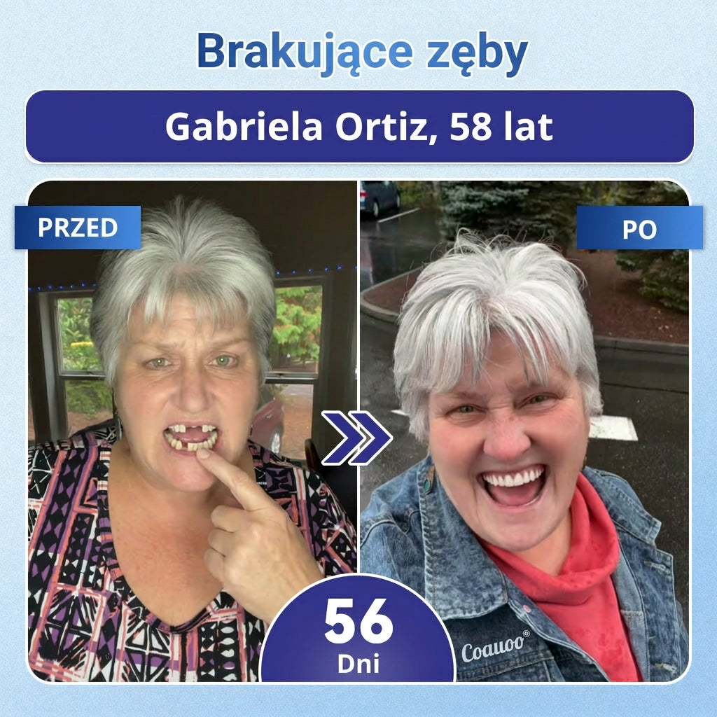 🦷 Pożegnaj nadwrażliwość i dyskomfort! 𝐂𝐨𝐚𝐮𝐨𝐨® paski oralne z Tideglusib – szybka regeneracja zębów i dziąseł 😊