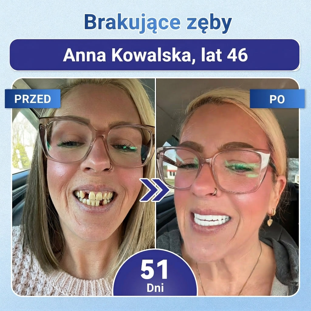 🦷 Pożegnaj nadwrażliwość i dyskomfort! 𝐂𝐨𝐚𝐮𝐨𝐨® paski oralne z Tideglusib – szybka regeneracja zębów i dziąseł 😊