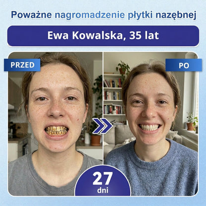🦷 Pożegnaj nadwrażliwość i dyskomfort! 𝐂𝐨𝐚𝐮𝐨𝐨® paski oralne z Tideglusib – szybka regeneracja zębów i dziąseł 😊