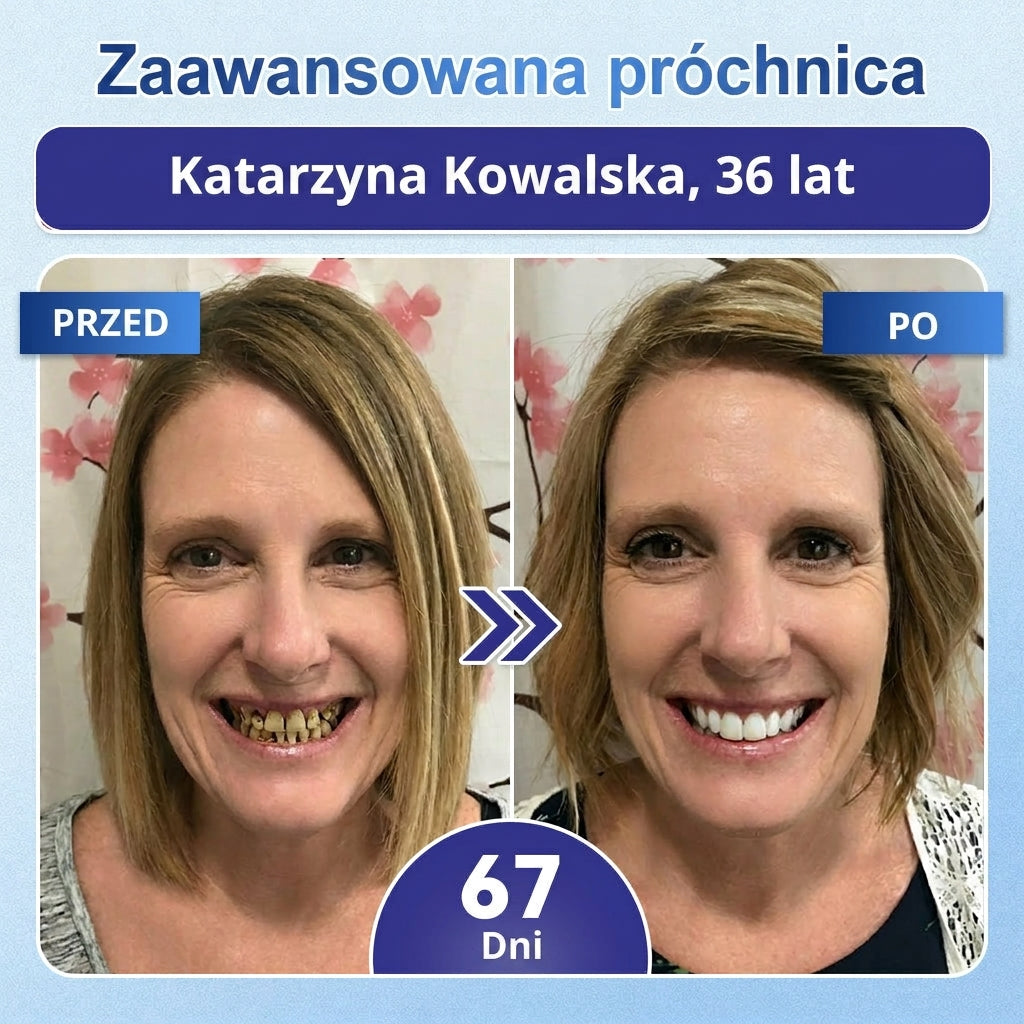 🦷 Pożegnaj nadwrażliwość i dyskomfort! 𝐂𝐨𝐚𝐮𝐨𝐨® paski oralne z Tideglusib – szybka regeneracja zębów i dziąseł 😊