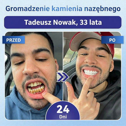 🦷 Pożegnaj nadwrażliwość i dyskomfort! 𝐂𝐨𝐚𝐮𝐨𝐨® paski oralne z Tideglusib – szybka regeneracja zębów i dziąseł 😊