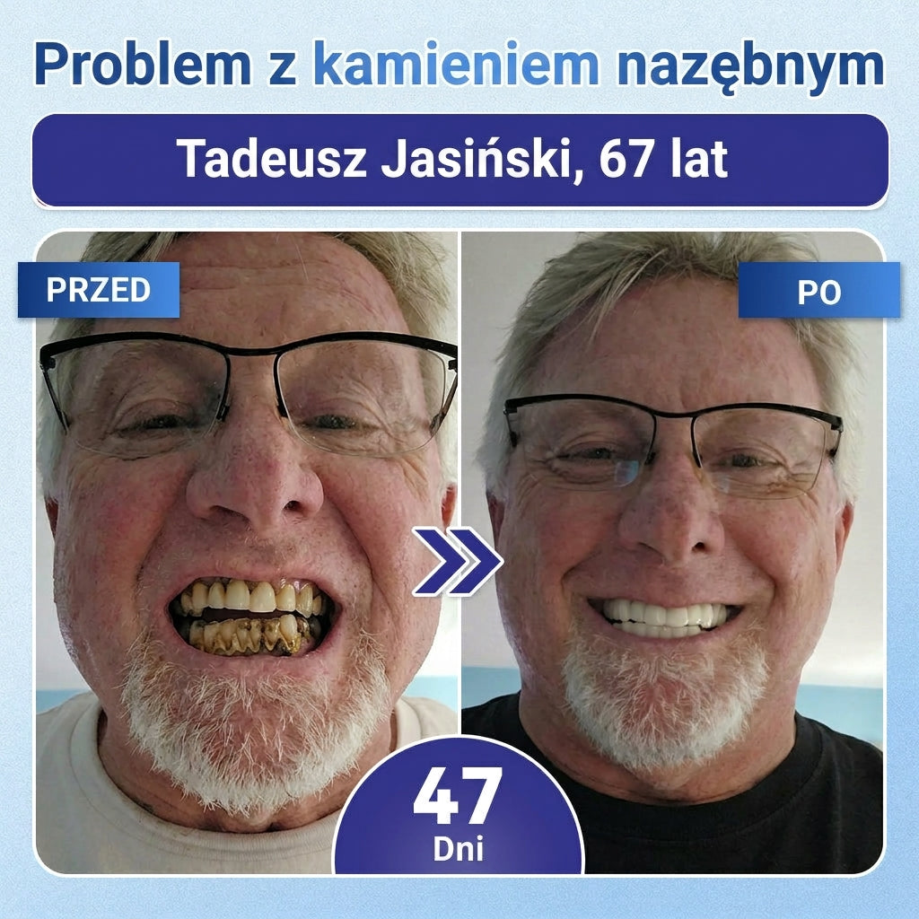 🦷 Pożegnaj nadwrażliwość i dyskomfort! 𝐂𝐨𝐚𝐮𝐨𝐨® paski oralne z Tideglusib – szybka regeneracja zębów i dziąseł 😊